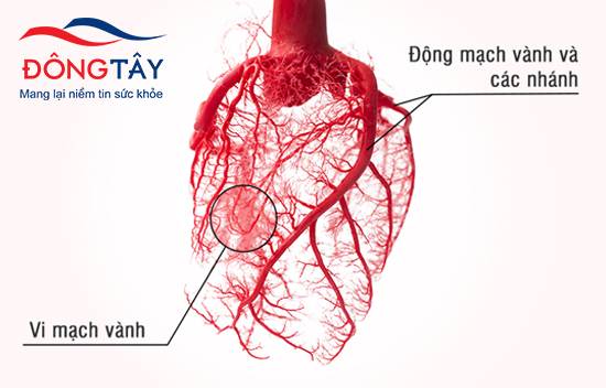 Rối loạn chức năng vi mạch vành là một trong hai nguyên nhân chính gây thiếu máu cơ tim ở người bệnh tiểu đường